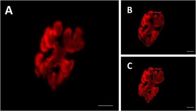 Ladder-based resistance training with the progression of training load altered the tibial nerve ultrastructure and muscle fiber area without altering the morphology of the postsynaptic compartment